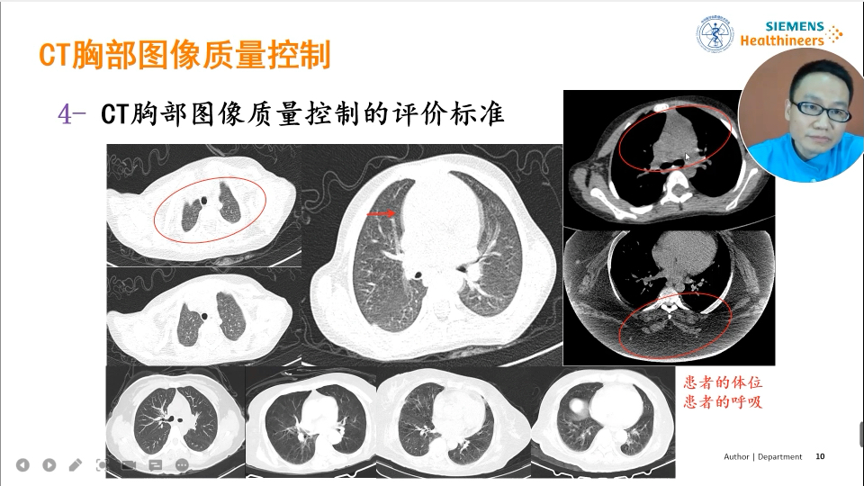 5.CT胸部图像质量控制哔哩哔哩bilibili