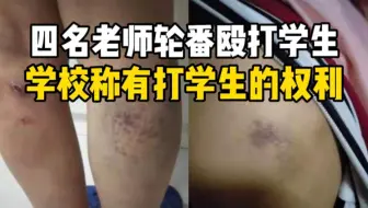 四名老师轮番殴打学生，学校称有打学生的权利