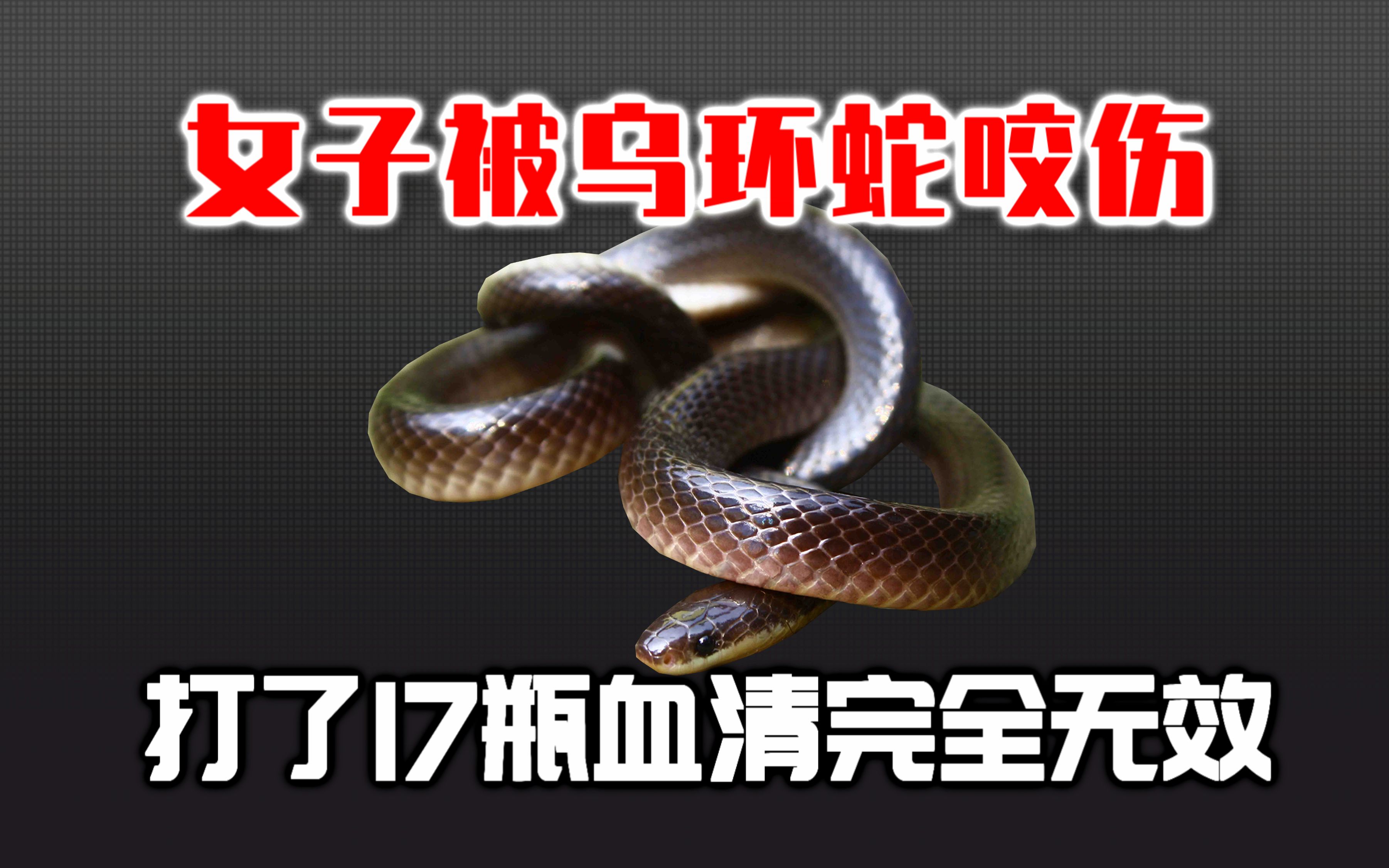 22岁女子被乌环蛇咬伤!打了17瓶抗毒血清都没用?转院途中不幸身亡!-龙雅不爱吃-龙雅不爱吃-哔哩哔哩视频