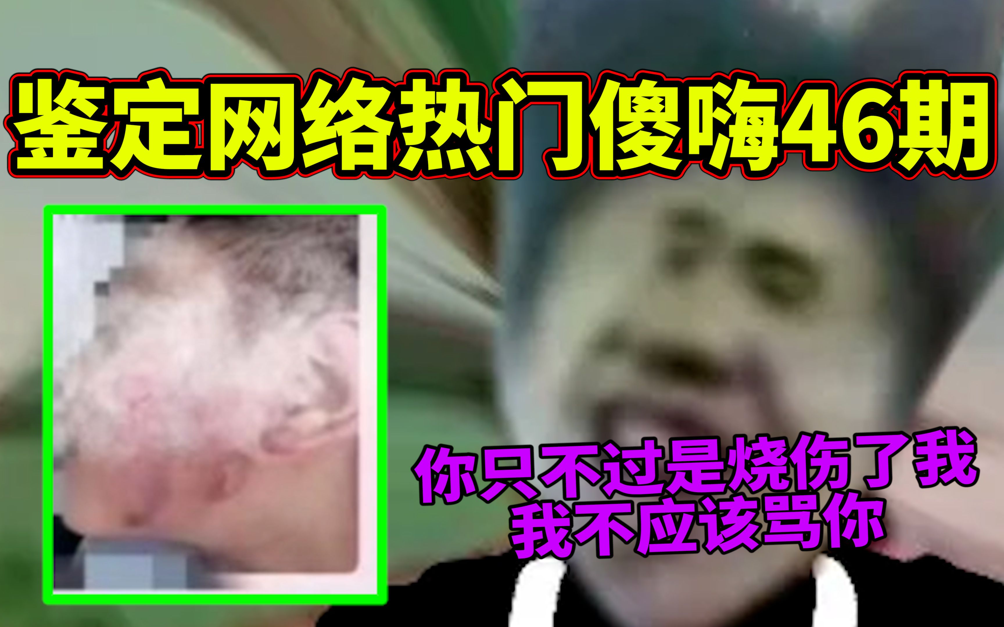 【鉴定网络热门傻嗨46期】我只不过烧伤你的脸!至于骂我吗?哔哩哔哩bilibili