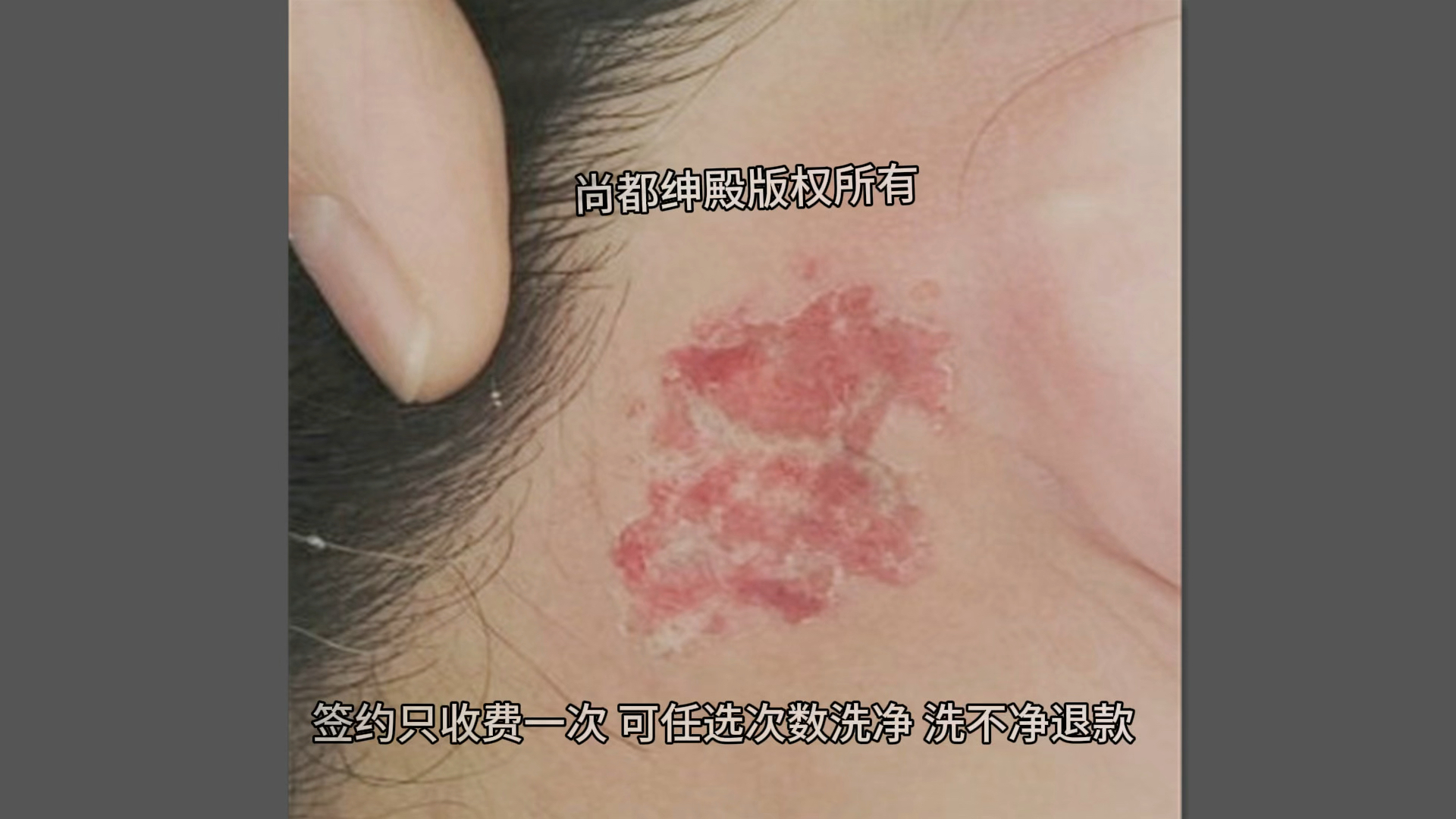 纹身洗净美美哒 #大连尚都绅殿洗纹身 #沈阳洗纹身哪里好 #洗纹身视频