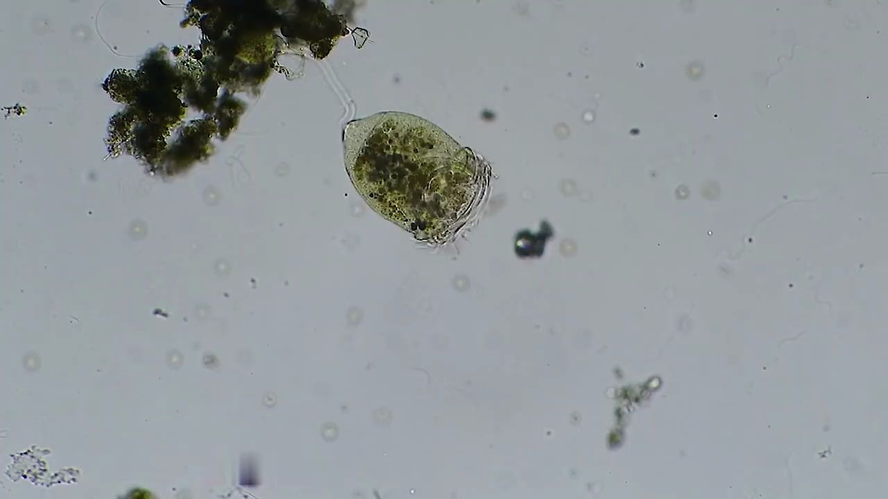 【微生物原生动物】游仆虫进食,感觉在吃豆子