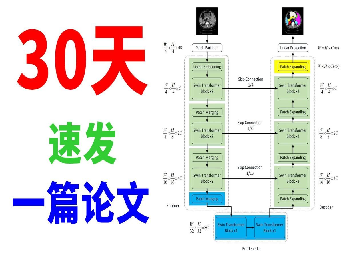 科研996:Swin UNet 30天拼手速发出来的论文?哔哩哔哩bilibili