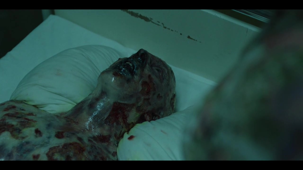 切尔诺贝利:这真的还是人吗?头发脱落,皮肤溃烂,都是因为核辐射!