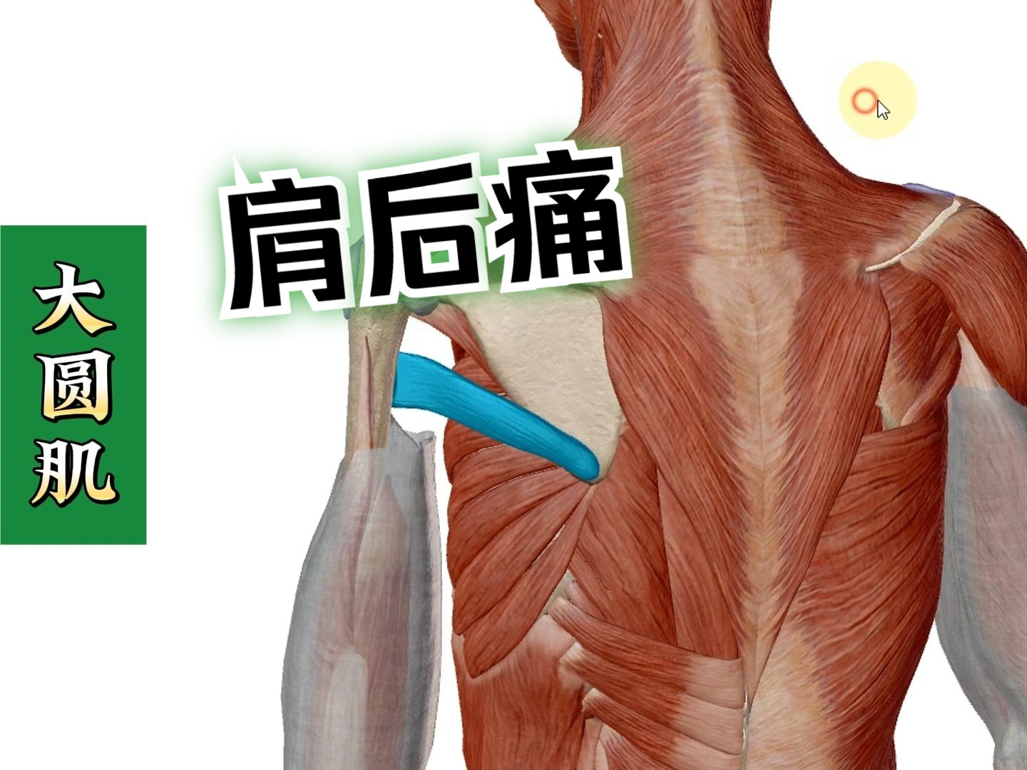 【大圆肌】——肩后痛,开重型车肩痛!