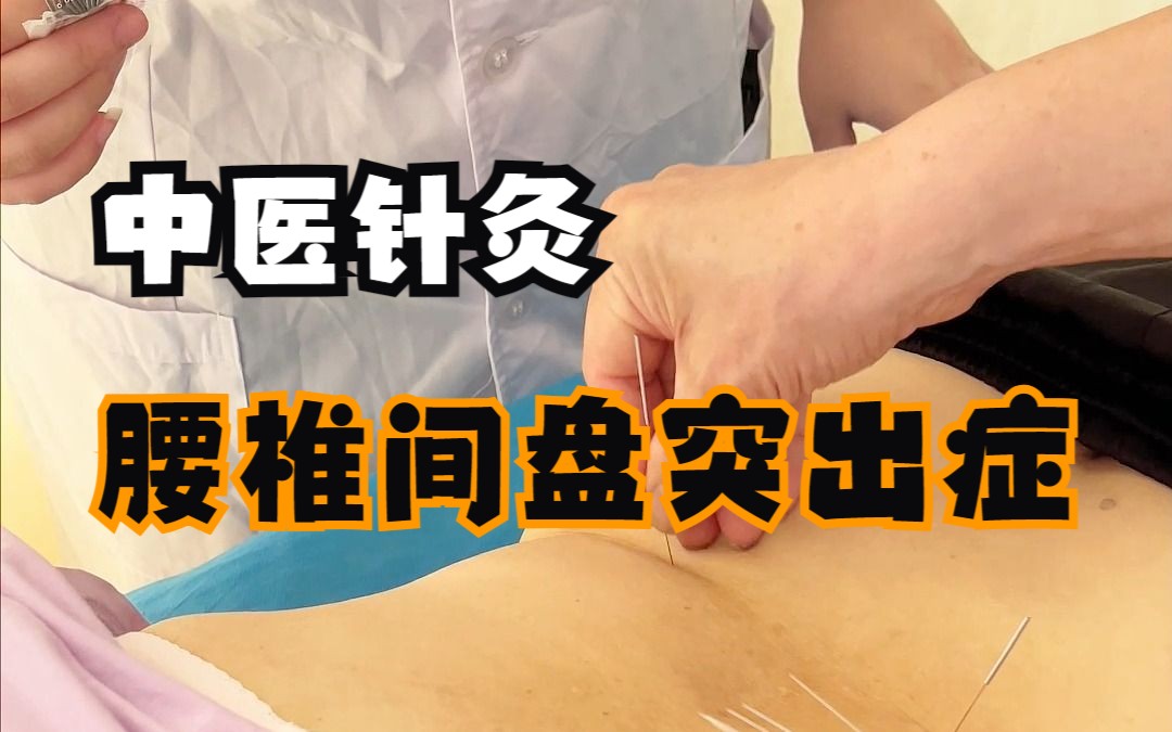 [图]【针灸】腰椎间盘突出症