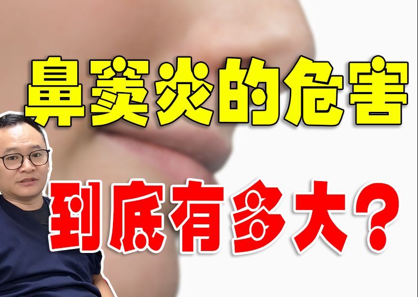 鼻窦炎的危害到底有多大?哔哩哔哩bilibili