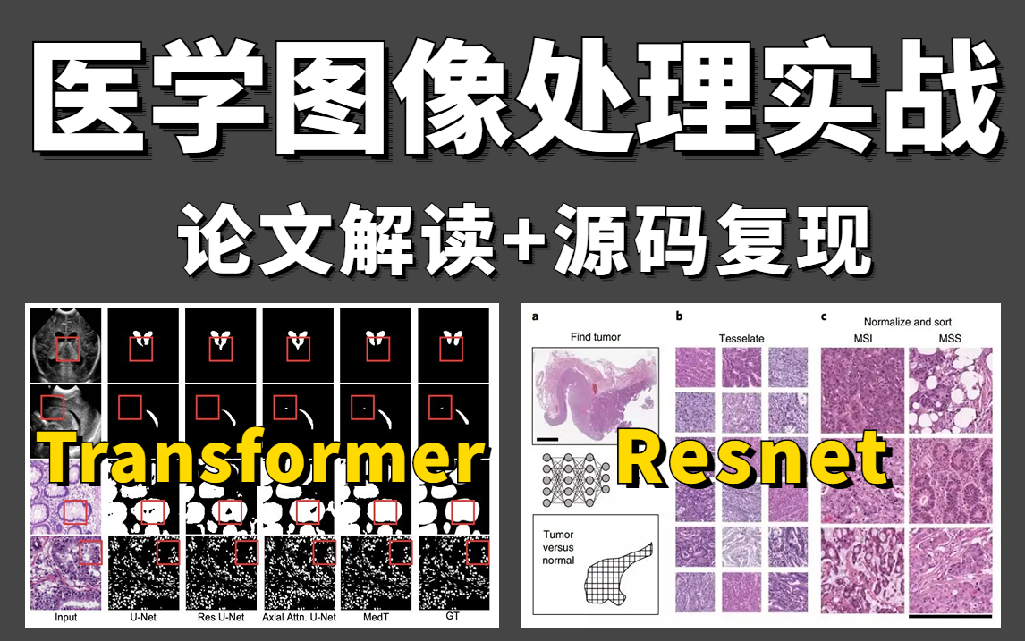 面向深度学习的医学图像处理实战教程:基于Transformer的医学图像分割+Resnet细胞分类实战教程,论文解读+源码复现!哔哩哔哩bilibili