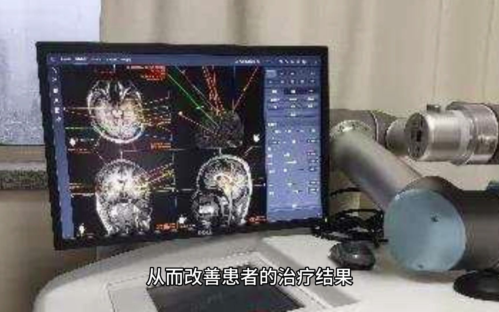 【数据分析】人工智能对医疗行业的重大改革,医疗投资人赶紧点进来!哔哩哔哩bilibili