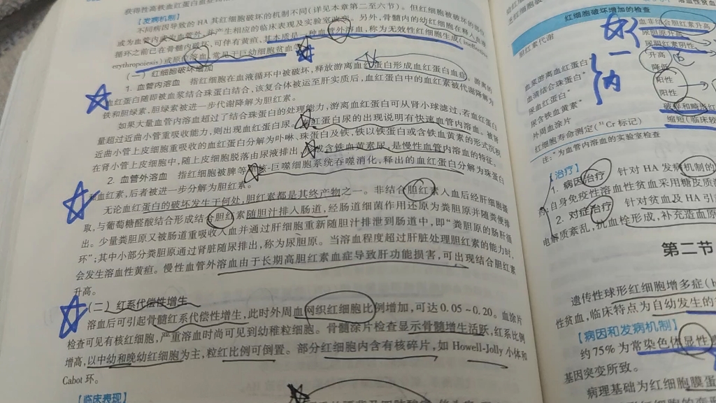 [图]溶血性贫血概述 血液病学中级考试 内科学