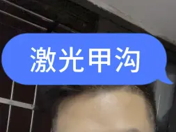 Descargar video: 被激光过的甲沟你见过吗？