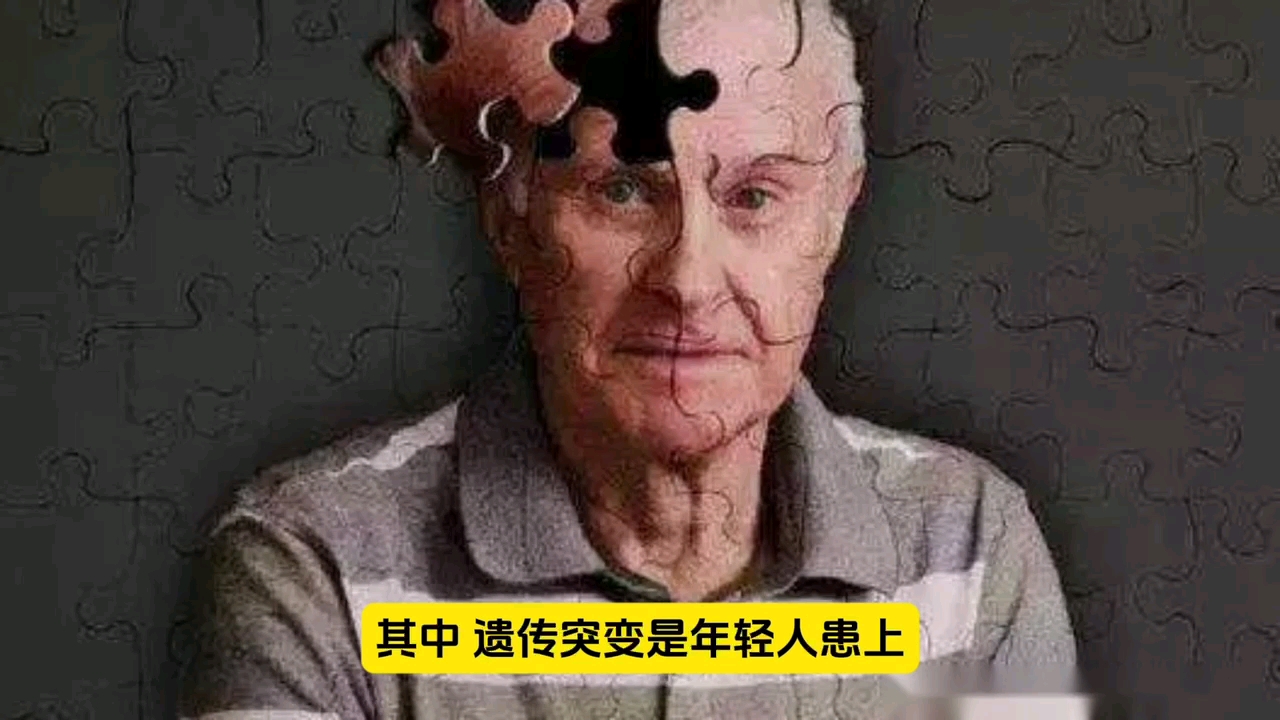 年轻人也能患上小脑萎缩?