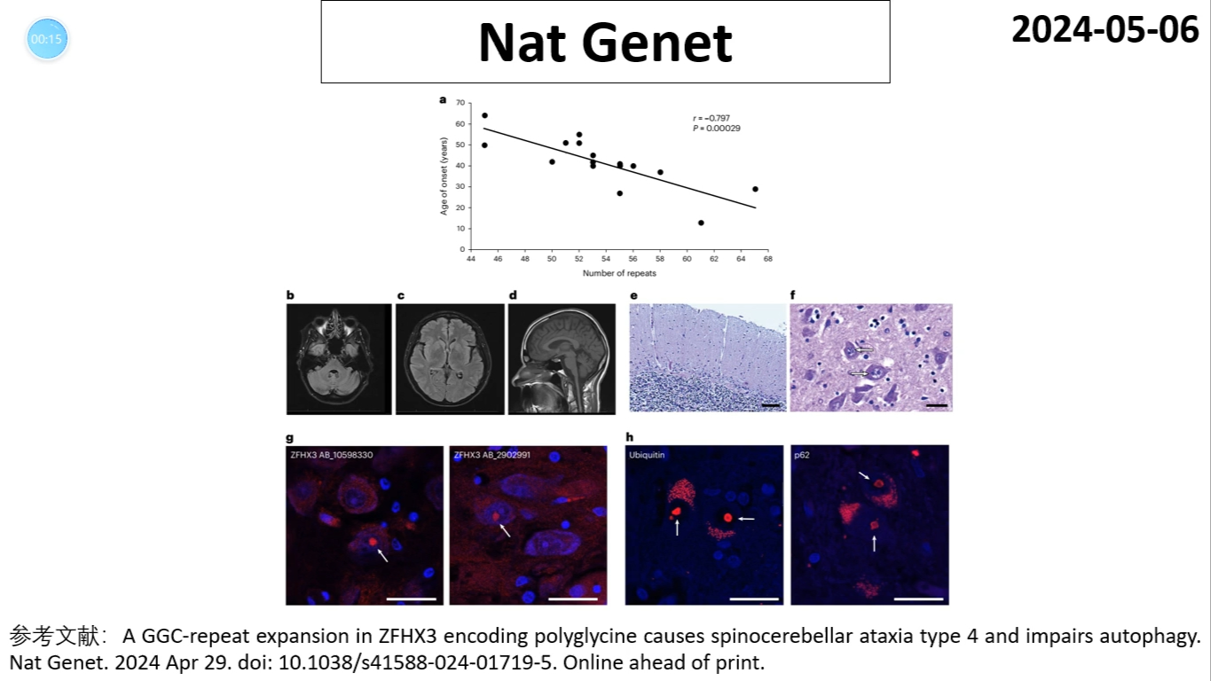 Nature genetics—神经遗传学研究重磅:ZFHX3基因GGC重复扩增引起SCA4并损害自噬功能哔哩哔哩bilibili