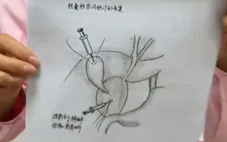 西安儿童医院护士手绘100幅儿童手术图,手绘形式记录手术过程哔哩哔哩bilibili