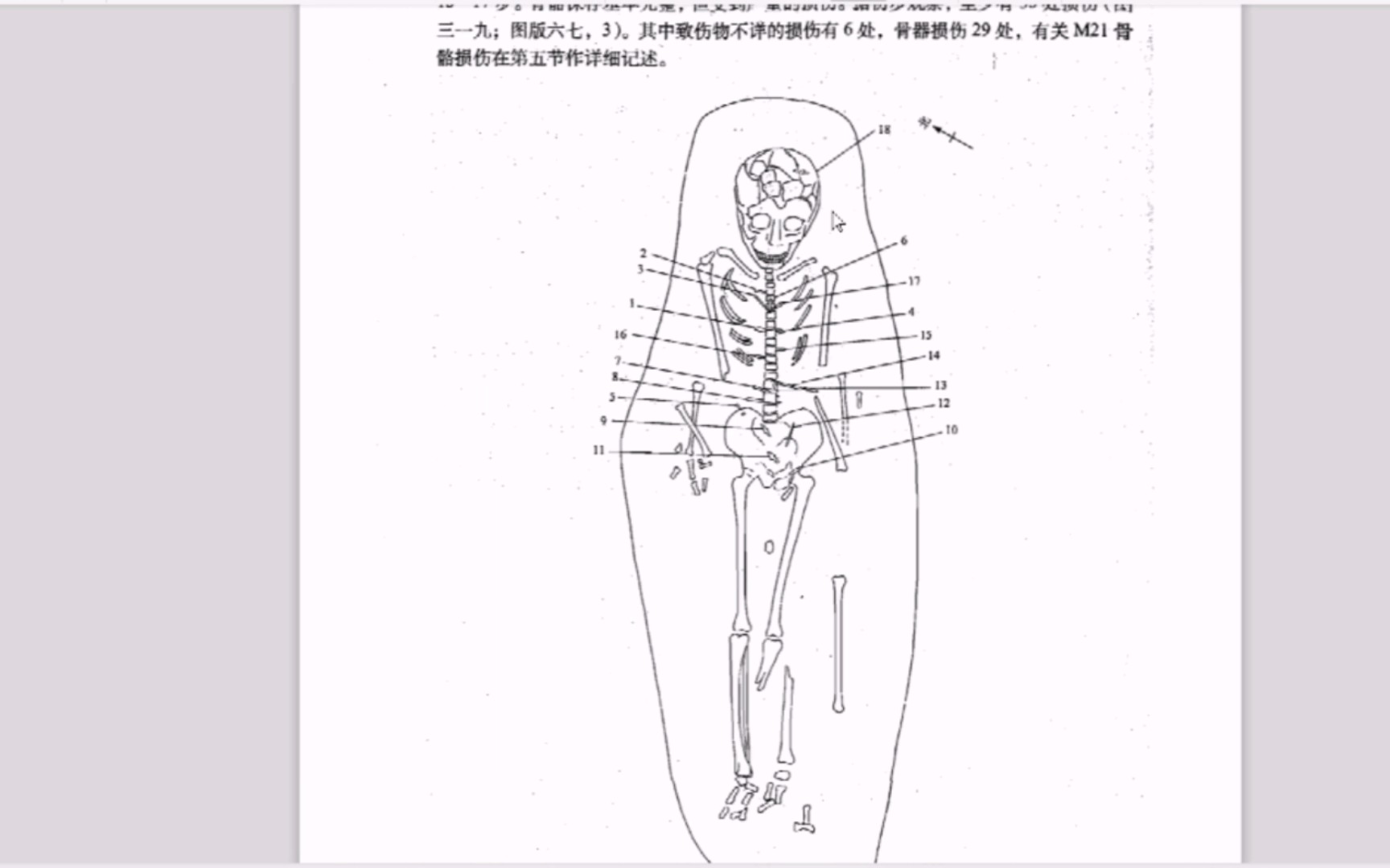 [古墓版囍](考古探秘——零口少女)比冥婚更恐怖的考古发现,妙龄少女竟被多人残忍围杀哔哩哔哩bilibili