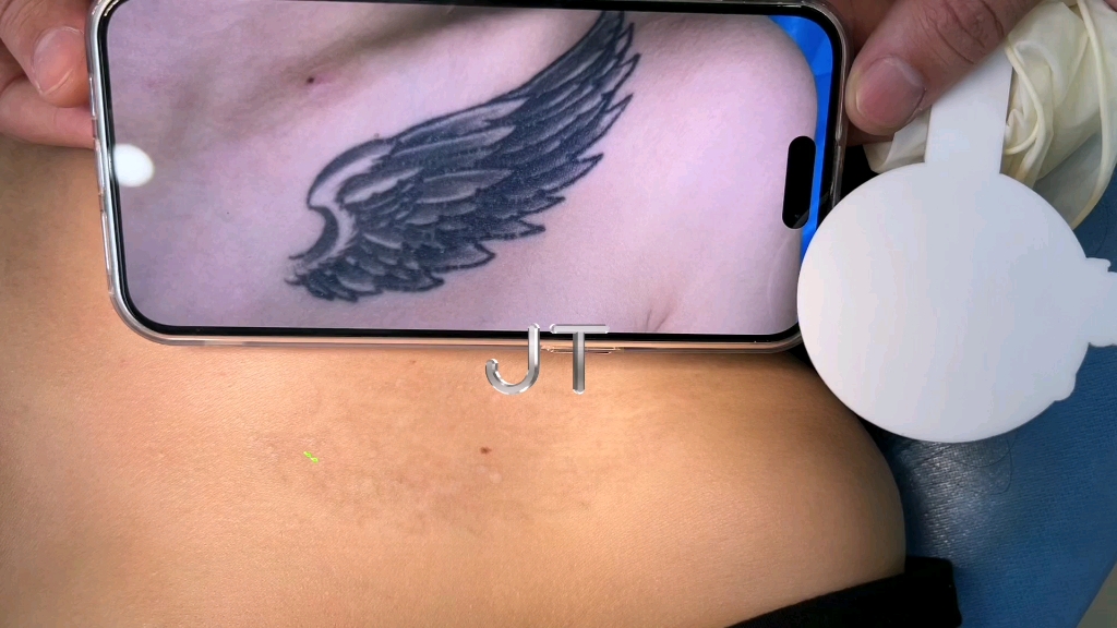 肩膀小翅膀纹身清洗对比