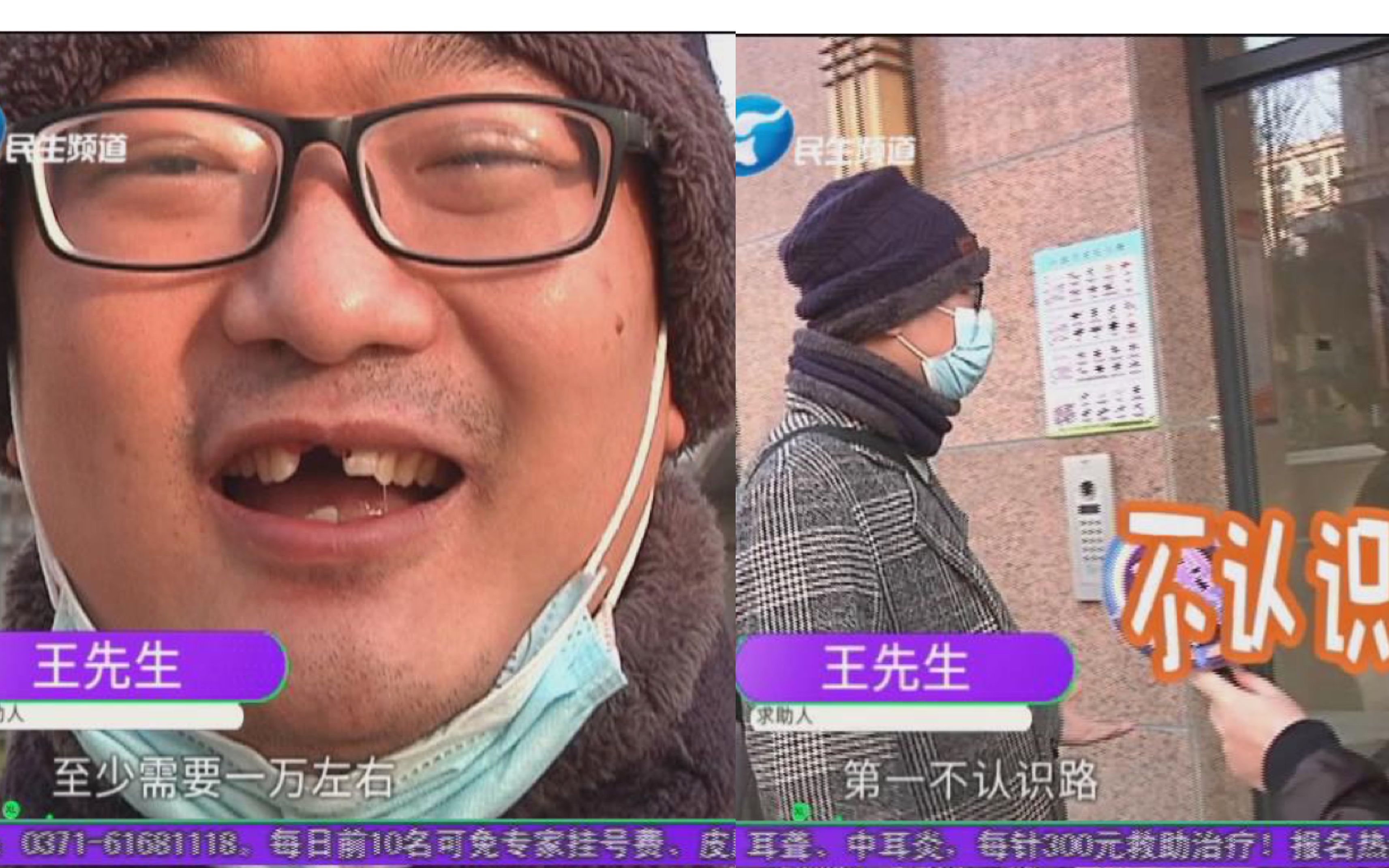 [图]男子说话跑风，大门牙去哪儿了？说起原因哭笑不得...