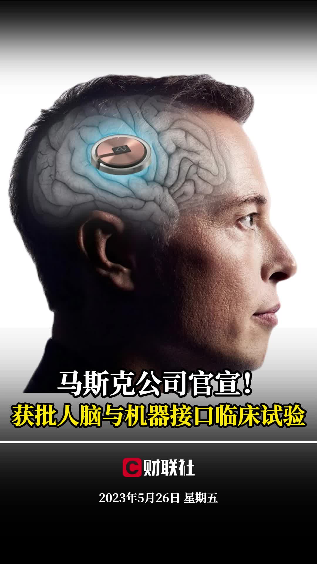 马斯克公司官宣!获批人脑与机器接口临床试验