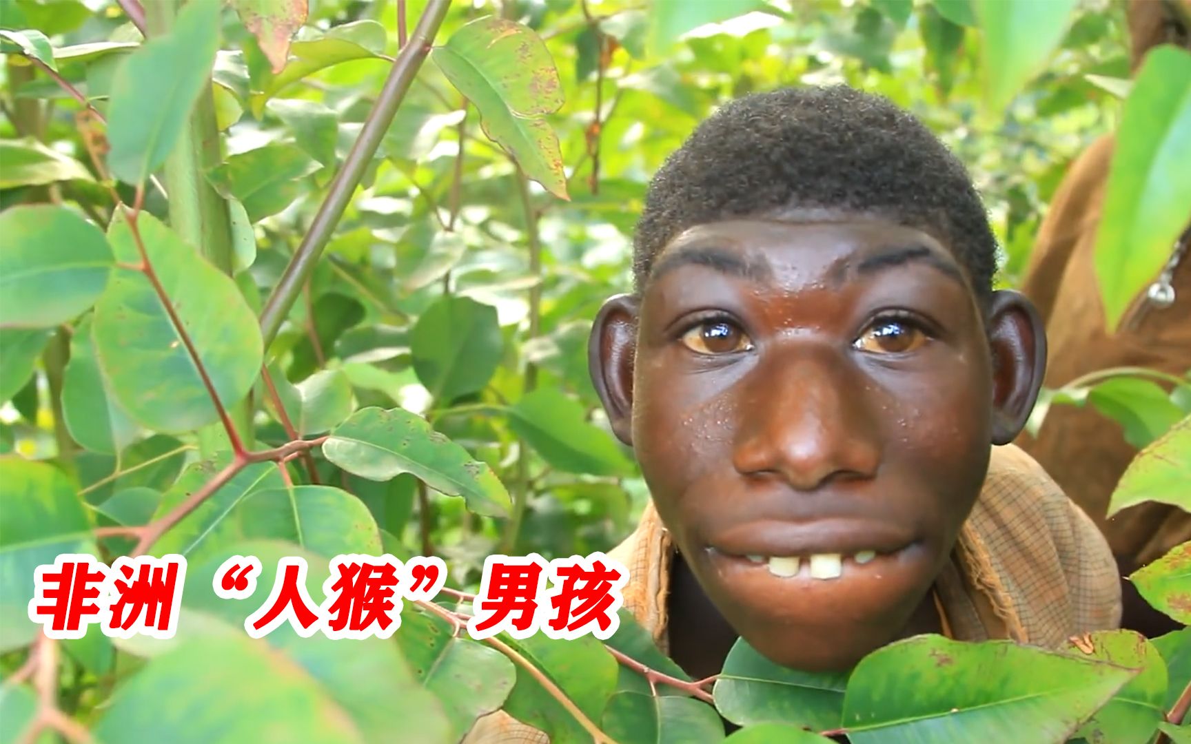非洲发现"人猴"男孩,不会说话只会叫,人和猴子生的?