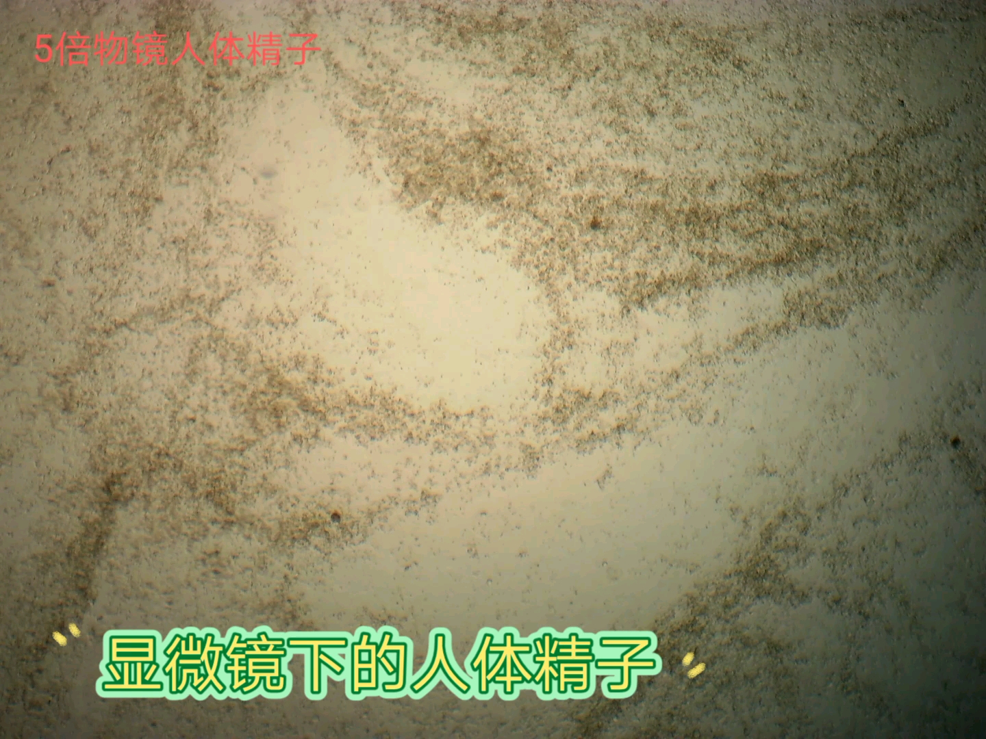 微观下人体精子动态哔哩哔哩bilibili