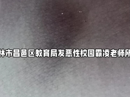 吉林市昌邑区第十三小学校戴世恒,书记张欣班主任赫丽艳祖力杨老用卑鄙的手段多次殴打虐待牙打掉一颗打住院我是孩子的母亲派出所把我非法拘禁24小时...