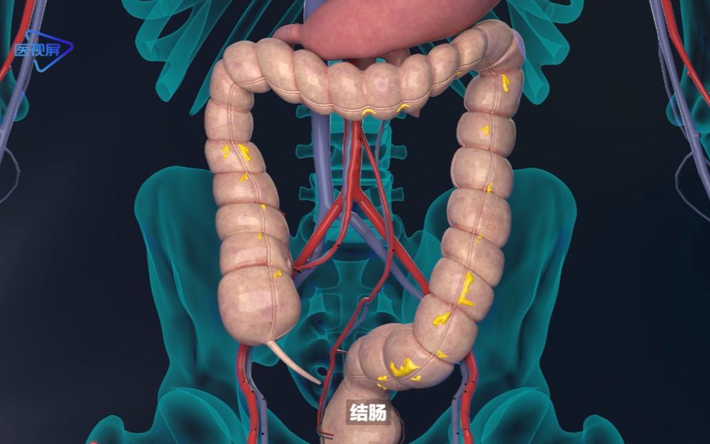肠结石该怎么判断(如何识别肠结石的症状)