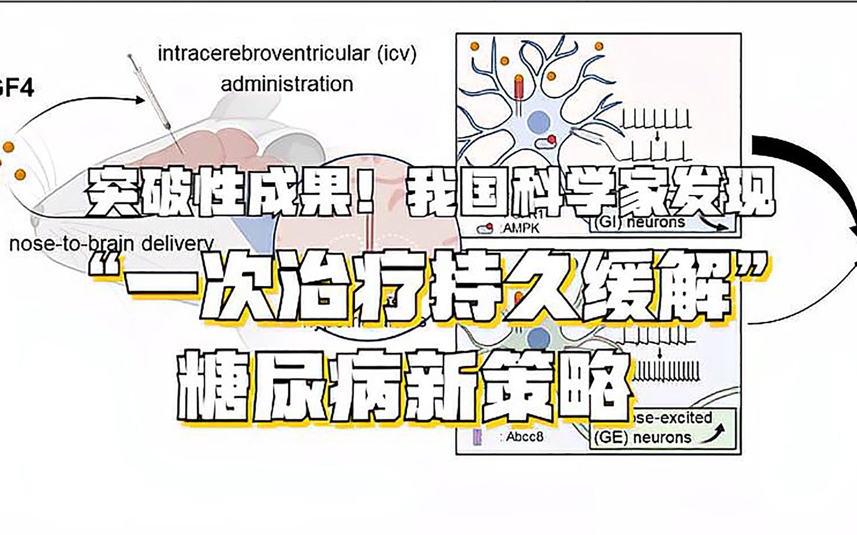 突破性成果!我国科学家发现“一次治疗持久缓解”糖尿病新策略哔哩哔哩bilibili