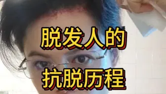 脱发人的抗脱历程