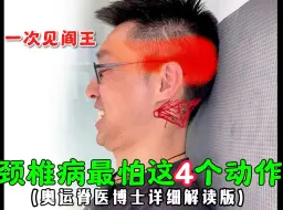 Télécharger la video: 颈椎最害怕4个动作，千万别乱做。不开玩笑