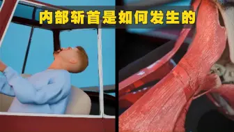 Download Video: 内部斩首是如何发生的？人还能活吗？