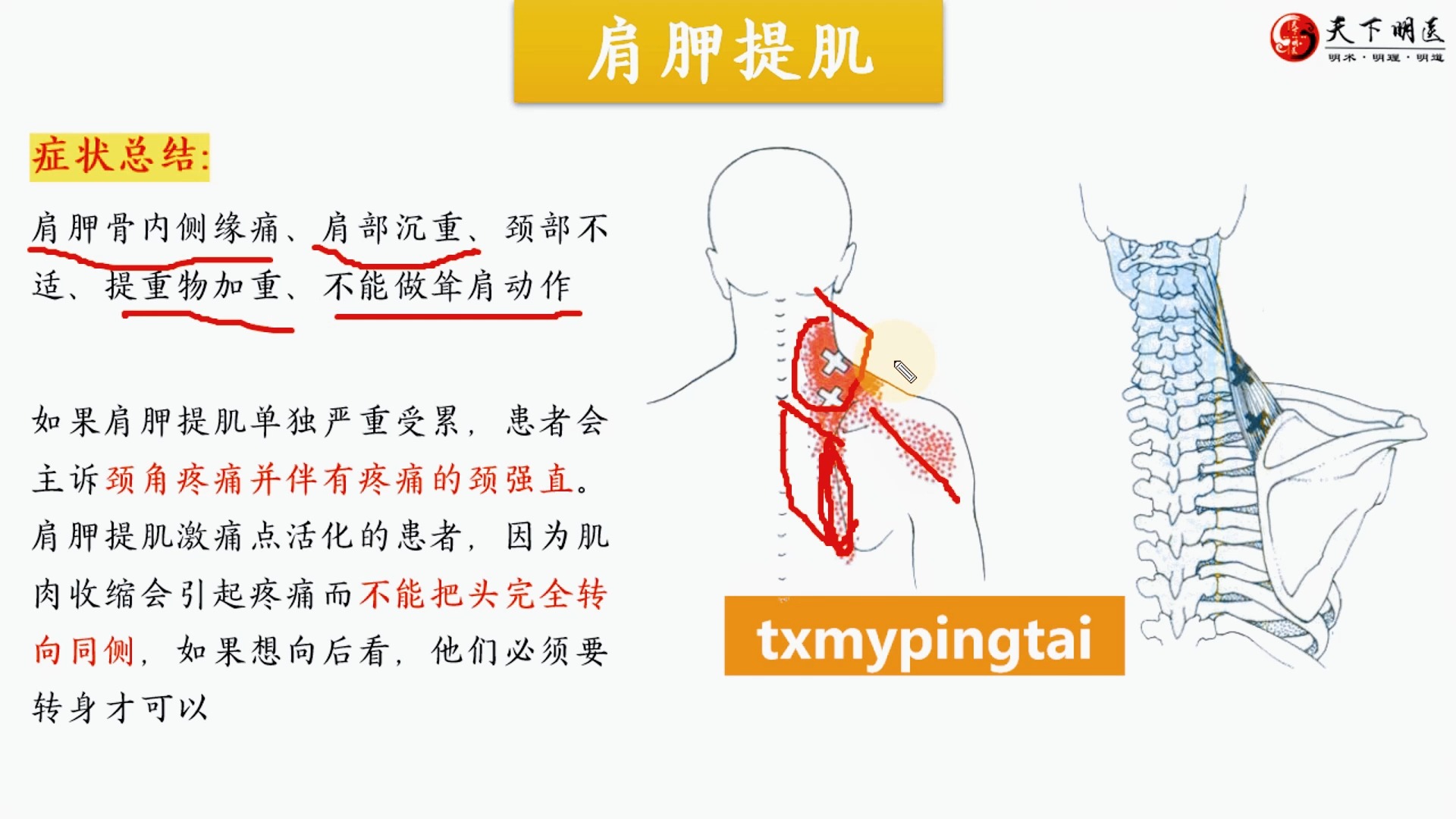 肩胛提肌肿大图片