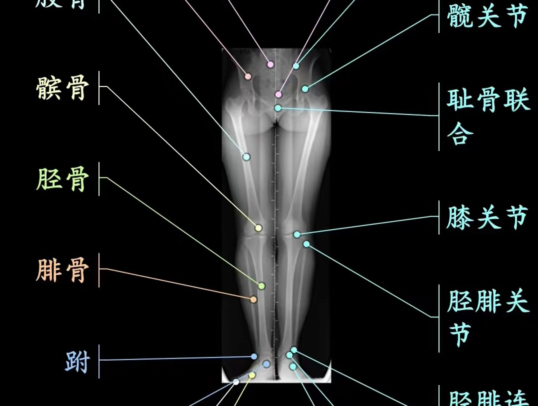 下肢x线解剖哔哩哔哩bilibili