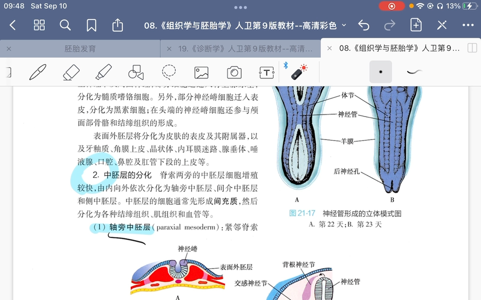 胚胎学/妇产科学——受精/着床/二胚层形成/三胚层形成/胎盘胎膜哔哩哔哩bilibili