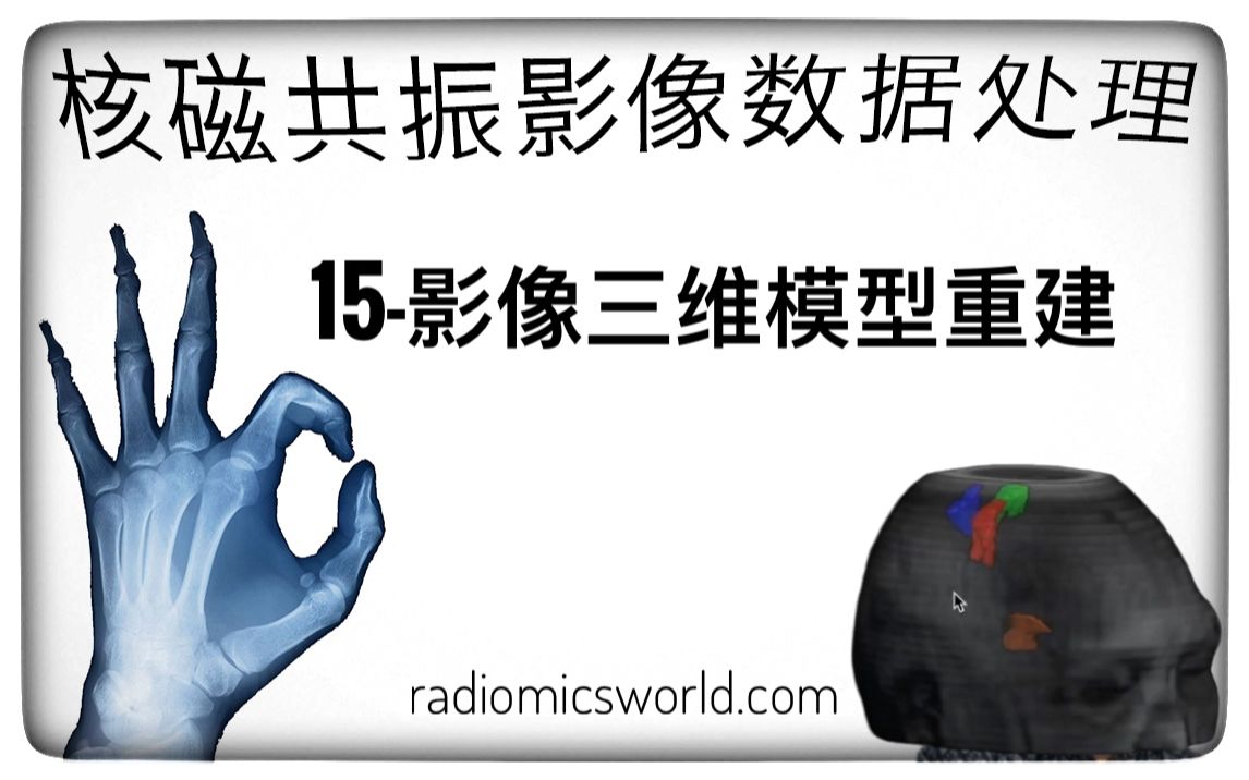 【核磁共振影像数据处理】5分钟学会核磁/CT医学影像三维重建,提高文章“颜值”哔哩哔哩bilibili