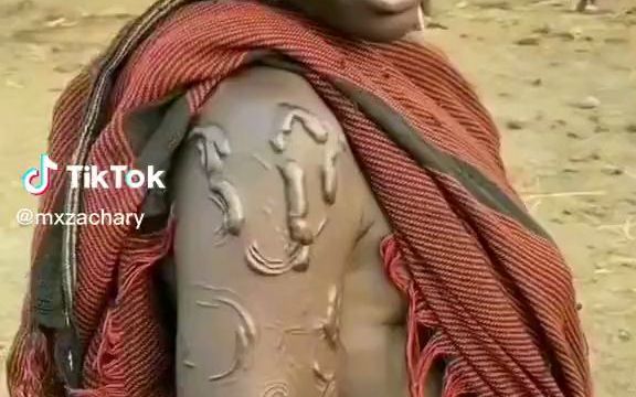 非洲某个部落,以烙铁在皮肤上烫出纹身为荣