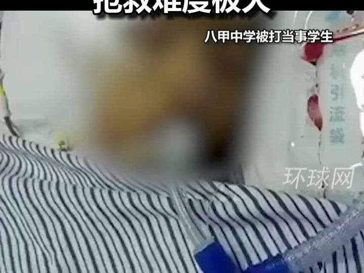 13岁中学生遭同学持扫棍殴打住进ICU,顶级专家称错过最佳时间抢救难度极大哔哩哔哩bilibili