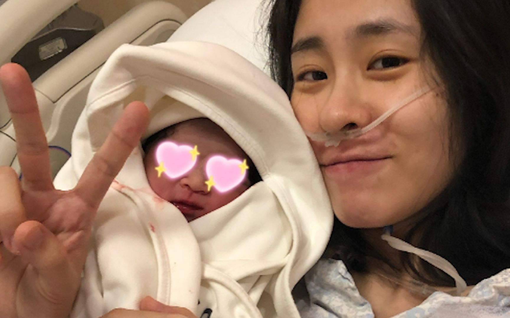 被质疑未生育张碧晨曝光生产照辟谣鼻子上插着氧气管表情痛苦