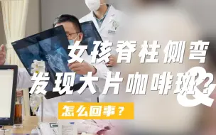 Download Video: 女孩背后还发现大片胎记，和脊柱侧弯有关吗？