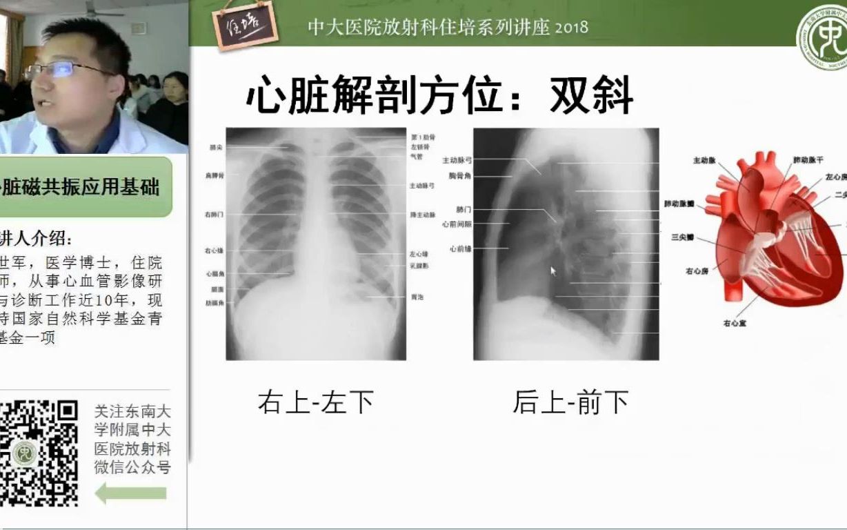 心脏磁共振成像应用基础中大张世军哔哩哔哩bilibili