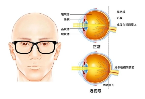 [图]音乐鉴赏九十五 白内障 八卦象数疗法  400·380