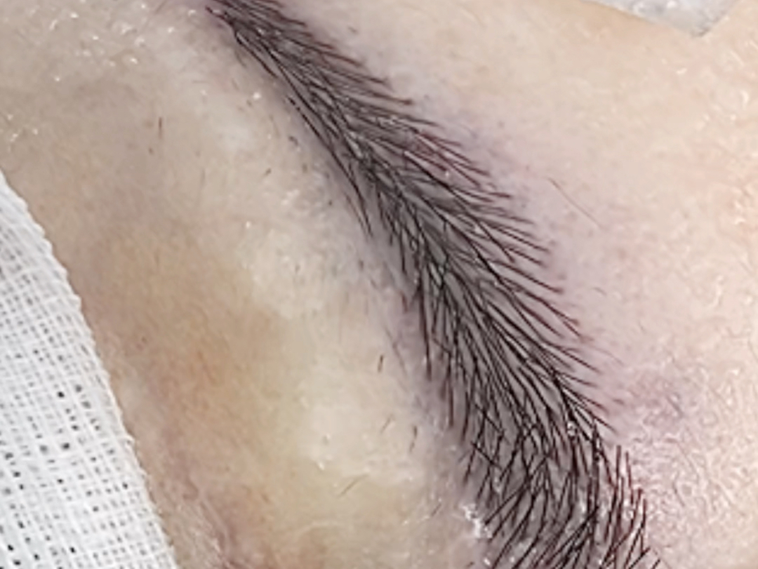 植眉后期效果.植眉到底是不是智商税