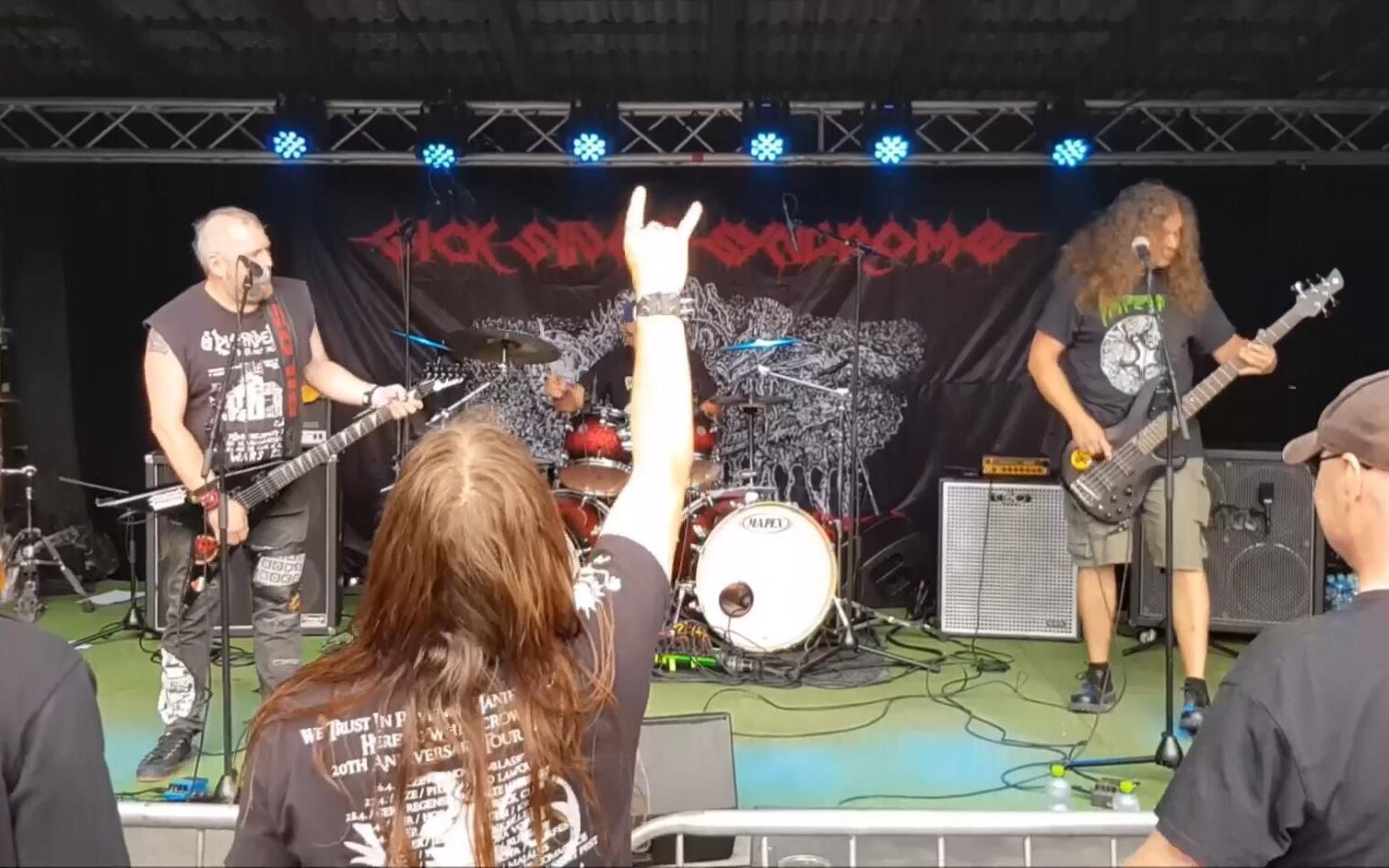 捷克血碾现场sicksinussyndromeobscuremoshopenairmodrávopice