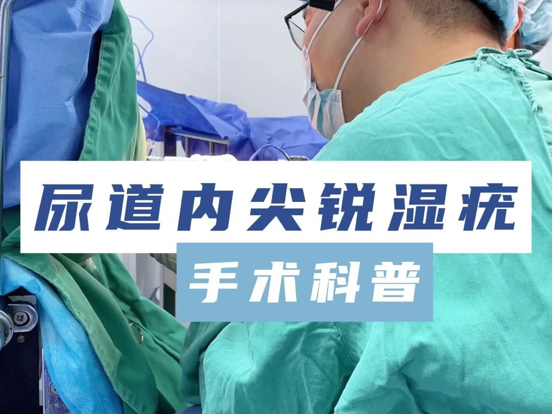 尿道内尖锐湿疣