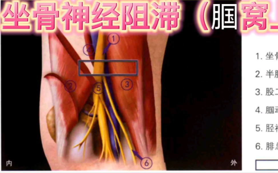 超声引导下坐骨神经阻滞(腘窝上)哔哩哔哩bilibili