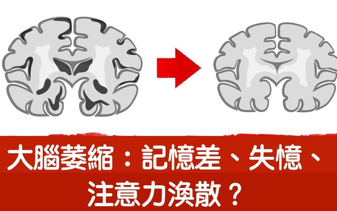 大脑萎缩吗?记忆差,注意力涣散,再生脑细胞有方法,自然疗法,柏格医生Dr berg哔哩哔哩bilibili