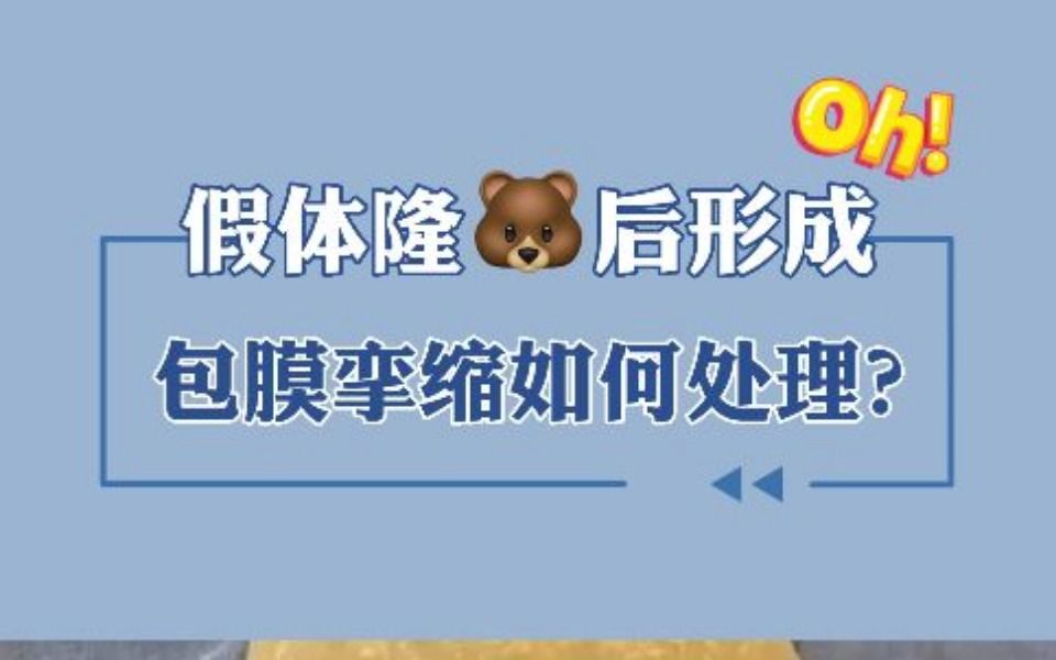 假体隆胸后,形成包膜挛缩要如何处理?哔哩哔哩bilibili