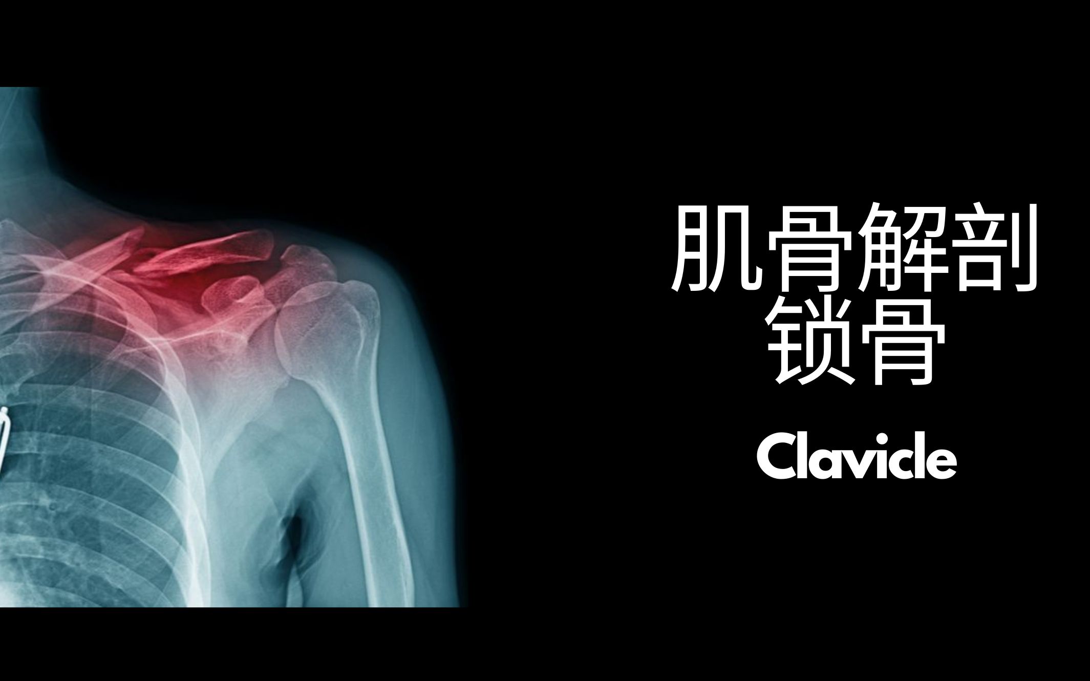 【物理治疗基础】肌骨解剖学习锁骨(Clavicle)#11哔哩哔哩bilibili