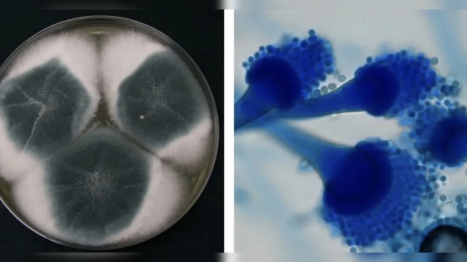 aspergillus fumigatus#烟曲霉