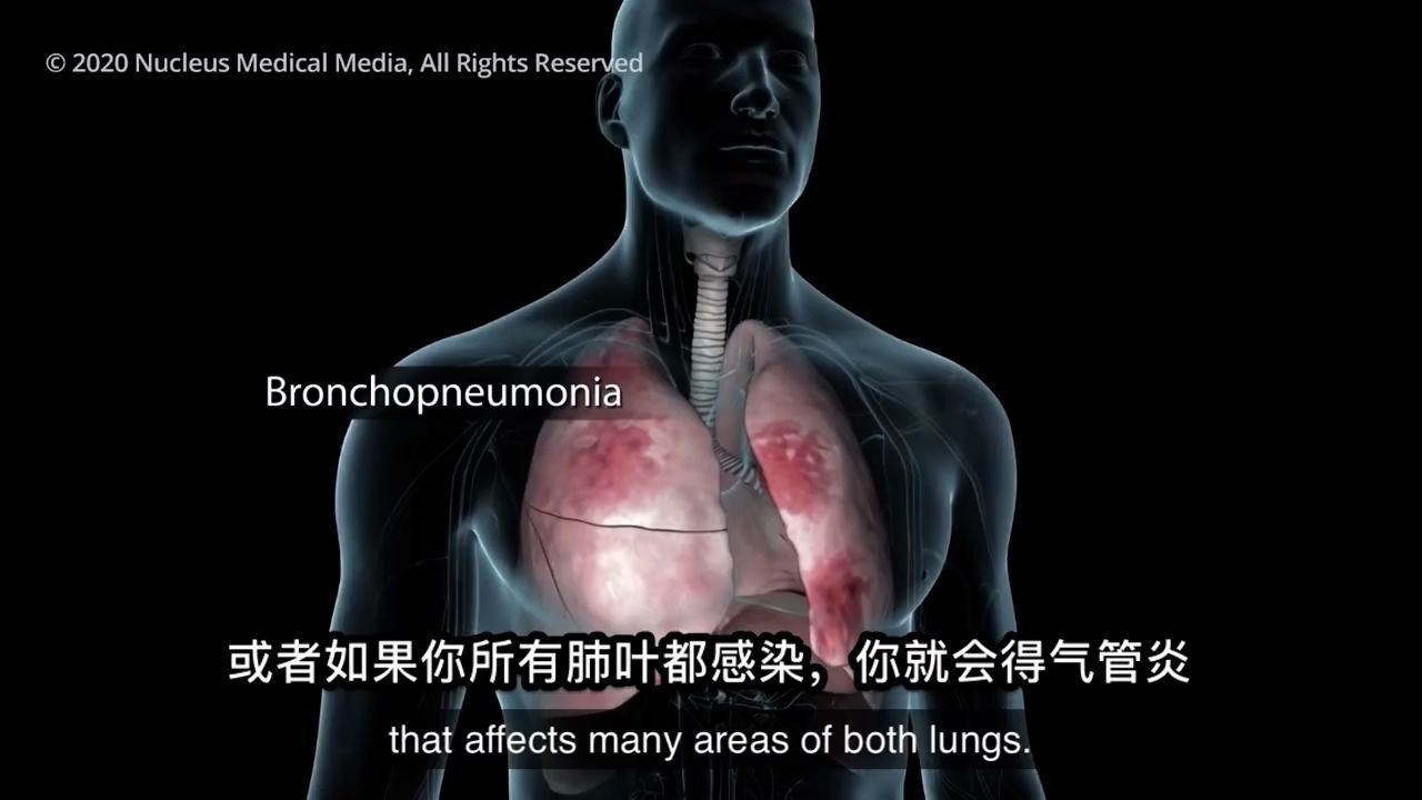 3d动画演示感染新冠全过程
