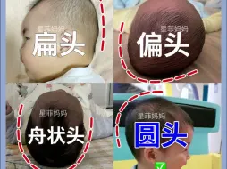 Download Video: 新生儿睡头型的方法